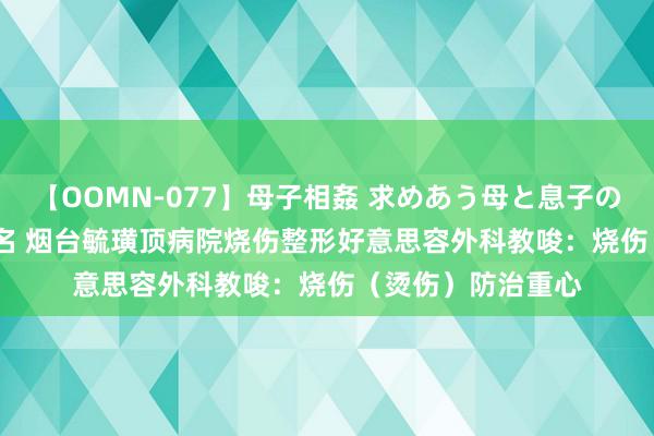 【OOMN-077】母子相姦 求めあう母と息子のムスコ 4時間 25名 烟台毓璜顶病院烧伤整形好意思容外科教唆：烧伤（烫伤）防治重心